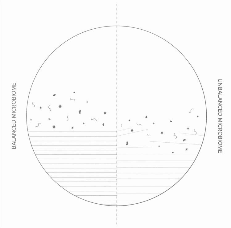 Comparison between balanced and unbalanced Skin Microbiome