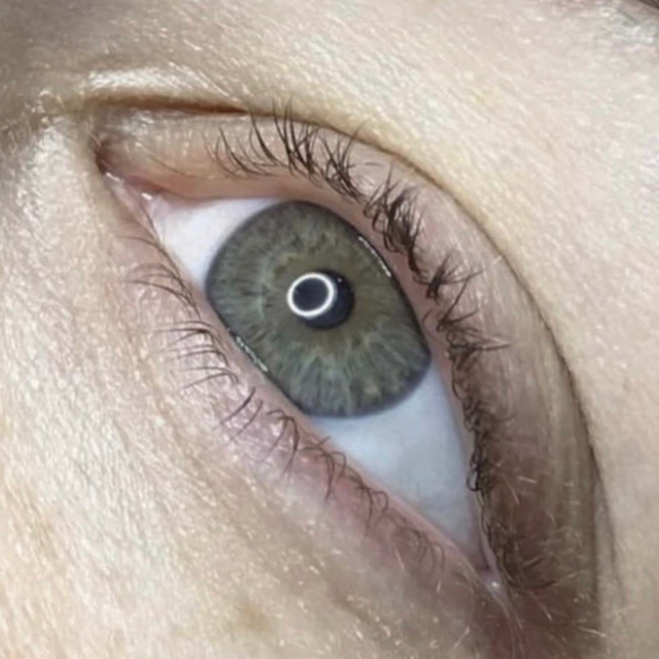 Sparse / brittle eyelashes.