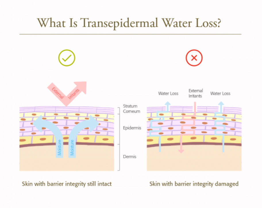Transepidermal Water Loss Diagram